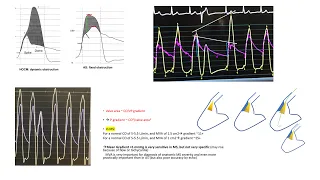 Hemodynamics: HOCM, aortic stenosis, valve area equations, pitfalls of guidelines cutoffs for AS +MS