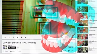 3D Video Extreme Teeth!!!