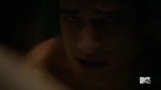 Teen Wolf - Scott Tries To Heal Himself