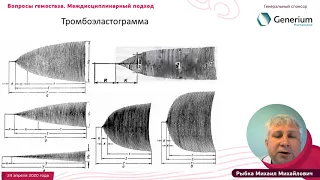 Проблема диагностики и коррекции гемостаза в кардиохирургии, Рыбка М.М.