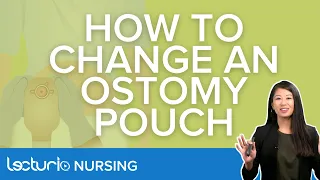 How To Change An Ostomy Pouch - Explanation & Demonstration | Lecturio Nursing