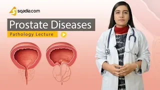 Prostate Diseases | Pathology Video Lectures | Medical Online Education | V-Learning