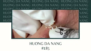 #185 | Huong Da Nang