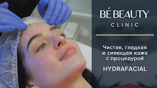 Описание процедуры HYDRAFACIAL ( Хайдрафэшл ) в Симферополе,  Крым.