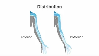 Performing an ultrasound guided interscalene brachial plexus block