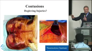 Spine Trauma - Injury Assessment - Jens R. Chapman, MD