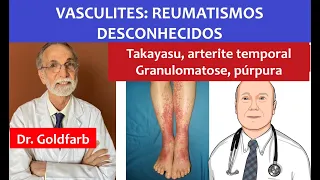 Vasculites essas desconhecidas: tipos principais e tratamentos que salvam vidas..