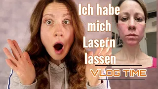 Meine Laser Behandlung beim Arzt- VLOG Time- Gegen Narben, Pickelmale, geplatzte Äderchen & CO