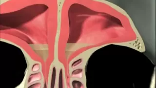 3D Sinus Animation