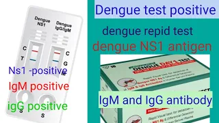 Dengue test positive /Ns1 antigen positive/igM/igG /dengue rapid test positive