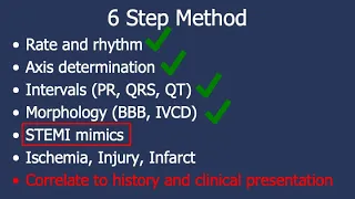 6-Step Method for 12-Lead ECG Interpretation