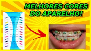 QUAIS AS MELHORES CORES PARA BORRACHINHA DO APARELHO ORTODÔNTICO? | AS TOP 10 MAIS PEDIDAS!!!