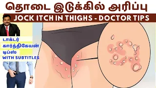 தொடை இடுக்கில் அரிப்பு நீங்க | jock itch dark skin spots black patches removal home remedies karthik