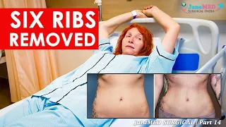 Ribs Removal | Hourglass Figure | Body Reshaping | JaneMED SURGICAL INDIA  | Part 14