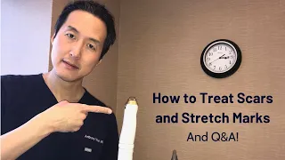 How to Treat Scars and Stretch Marks - Dr. Anthony Youn