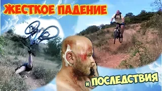 Жёсткое падение с велосипеда и последствия!