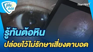 รู้ทันต้อหินปล่อยไว้ไม่รักษาเสี่ยงตาบอด | รู้ทันกันได้ | วันใหม่วาไรตี้