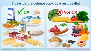 What is a colonoscopy and how do I prepare for it?