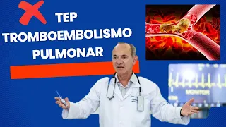 TEP Embolia Pulmonar - Aprenda tudo sobre Tromboembolismo Pulmonar