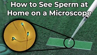 How to See Sperm at Home Under a Microscope