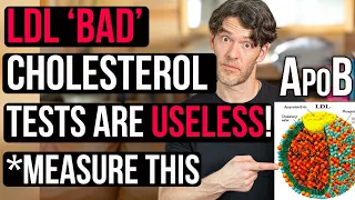 LDL-Cholesterol is USELESS! Measure this Instead: ApoB