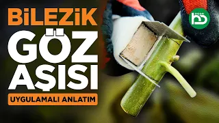 Bilezik Göz Aşısı Nasıl Yapılır, Bilezik Göz Aşısı Ne Zaman Yapılır. Uygulamalı Anlatım (gözaşısı/5)