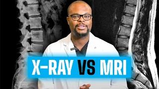 MRI vs X Ray : What’s the difference?