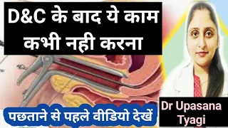 D&C के बाद ये काम कभी नही करना। Don't do all this after D&C in Hindi। Dilation and curettage