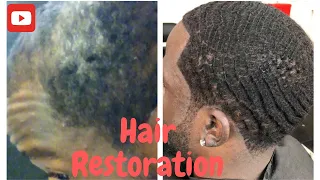 How I Grew My Hair Back//Hair Restoration//Natural hair growth