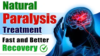 Natural Paralysis Treatment - Fast and Better Recovery | Brain Stroke Recovery | Dr. Puru Dhawan