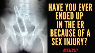 Askreddit. Sex Accidents That Ended up In The Emergency Room. Reddit stories.