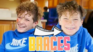 GETTING BRACES FINALLY FOR THE FIRST TIME | SECOND CHILD TO GET BRACES | IDENTICAL TWIN GETS BRACES