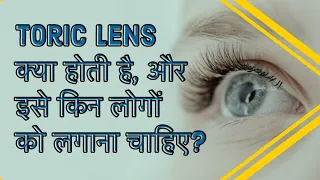 What are Toric Lenses & who should get them?