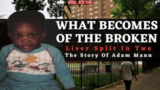 Liver Split In Two, Every Bone In His Body Broken - The Story Of Adam Mann