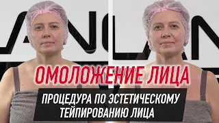 ✅ ОМОЛОЖЕНИЕ ЛИЦА.  ПРОЦЕДУРА ПО ЭСТЕТИЧЕСКОМУ ТЕЙПИРОВАНИЮ ЛИЦА | Валентин Гайт | BBALANCE