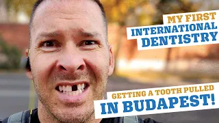 I Got A Tooth Pulled In Budapest!? My Dental Tourism Experiment...