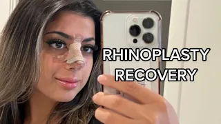 Rhinoplasty Recovery Q&A
