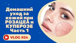 #24 Домашний уход за кожей при розацеа и куперозе. Советы косметолога. Часть 1.