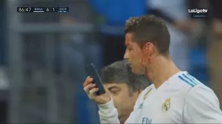 Cristiano Ronaldo Lesión en la cara - Real Madrid vs Deportivo La Coruna 7-1 - La Liga 21/01/2018