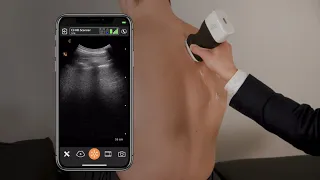 Lung Ultrasound Scanning