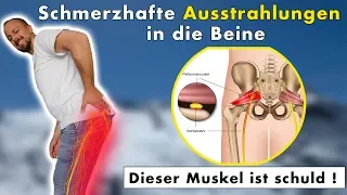 Ischialgie, ischiasschmerzen (ist KEIN Nervenschaden) | Piriformissyndrom & Ischias DIE LÖSUNG