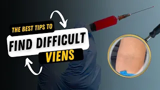 Trouble Locating & Palpating Difficult Veins? Here are The BEST TIPS to Stick That Vein!!