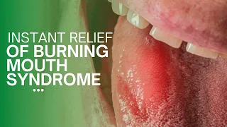 Instant relief from burning mouth syndrome