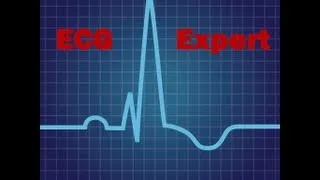 Interpret ECG changes in various Diseases (How to Read ECG?)