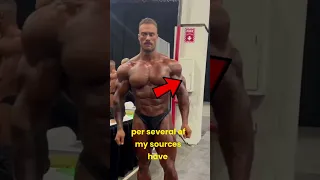 CBum Won the Olympia With Torn Biceps?