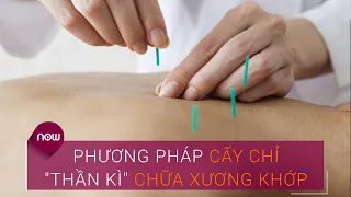 Cấy chỉ: Phương pháp "thần kì" điều trị bệnh xương khớp | VTC Now