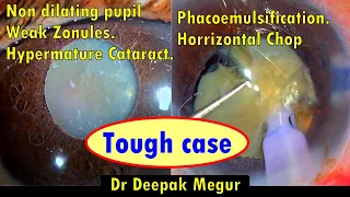 Managing A Tough Case: the Secret is Planning. -Dr Deepak Megur.