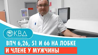 💣 ВПЧ 6,26, 51 и 66 на лобке и члене у мужчины. Клинический случай №569