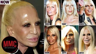 Top 10 Celebrities with TERRIBLE Plastic Surgery