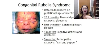 Rubella video